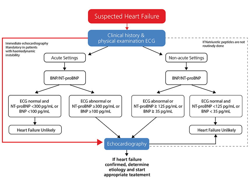 Acute heart failure guidelines esc
